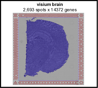 Visium_brain