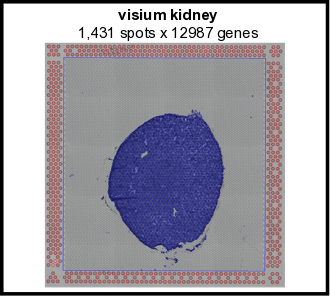 Visium_kidney